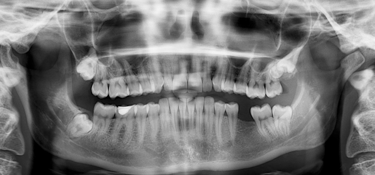 pruebas radiológicas en odontología